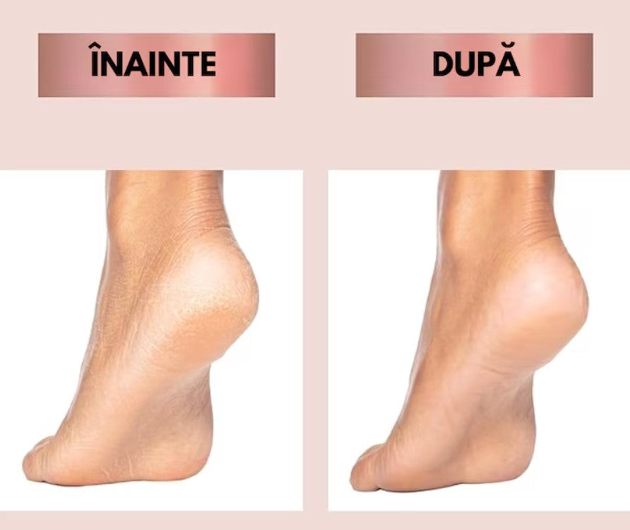 🦶Pila electrica Hozro®, portabila, pentru talpi si calcaie, reincarcabila, lumina LED, 2 capete interschimbabile, 2 trepte viteza, roz HOZRO