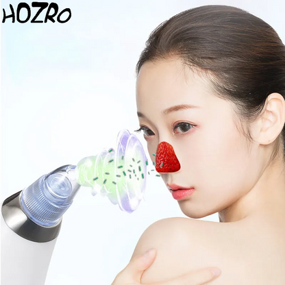 Aparat Vacuum HOZRO, Derma Suction pentru Curățarea Tenului, Îndepărtarea Punctelor Negre și Exfoliere Delicată, cu Capete Interșchimbabile și Putere Reglabilă – Îngrijire Profesională la Tine Acasă HOZRO