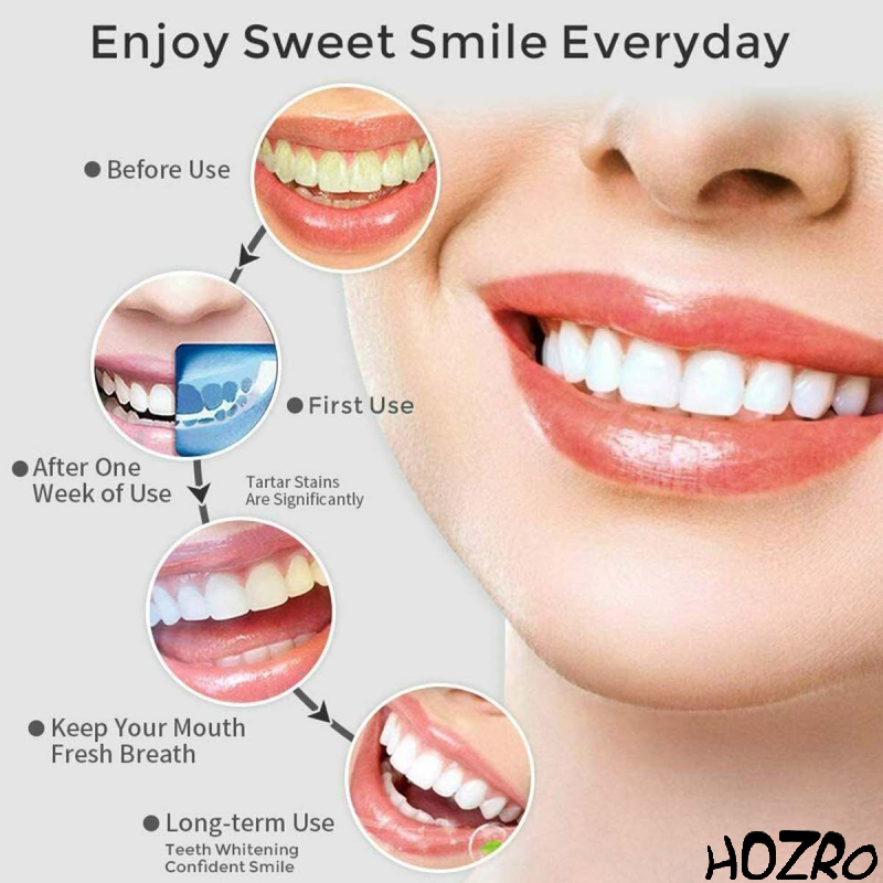 Irigator Bucal Portabil HOZRO, 3 Moduri de Intensitate, Rezistent la Apă, 220ml, Compact și Ușor de Folosit – Curățare Eficientă și Practică a Dinților și Gingiei HOZRO