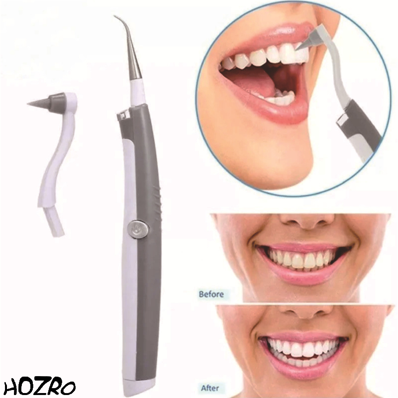🦷 Aparat Sonic HOZRO, Pentru Detartraj – Curățare Profesională a Dinților, Îndepărtare Tartru, Pete și Placă Bacteriană, pentru un Zâmbet Alb și Sănătos HOZRO