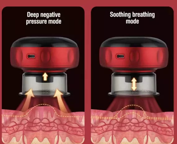 Aparat de Masaj Tip Ventuză Electrică HOZRO, cu Vacuum Puternic, Infraroșu, Display LCD și Funcție Anticelulitică – Tonifiere Corporală, Relaxare Musculară, Model R18-03, Roșu/Negru HOZRO