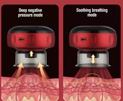 Aparat de Masaj Tip Ventuză Electrică HOZRO, cu Vacuum Puternic, Infraroșu, Display LCD și Funcție Anticelulitică – Tonifiere Corporală, Relaxare Musculară, Model R18-03, Roșu/Negru HOZRO