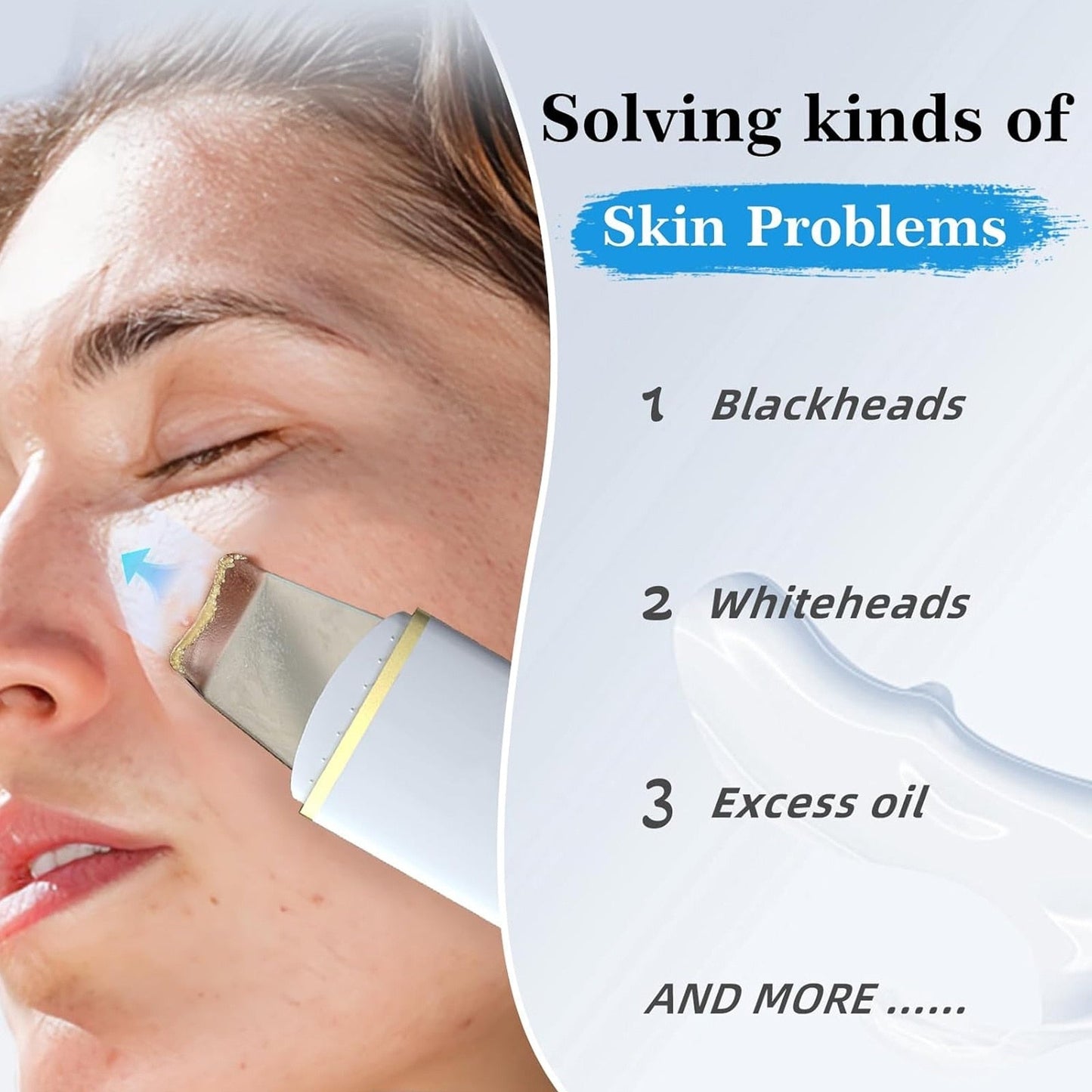 Exfoliant Hozro ultrasonic electric pentru curatarea profunda a pielii, instrument de frumusete, eliminare puncte negre, curatare pori, lifting ten, skin scrubber, peeling HOZRO
